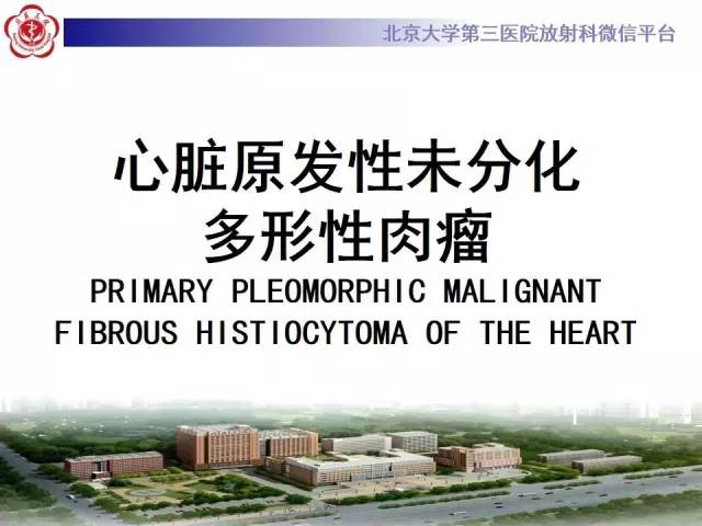 【病例】心脏原发性肿瘤1例CT影像表现