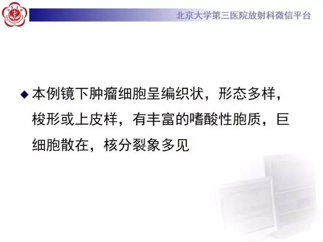 【病例】心脏原发性肿瘤1例CT影像表现