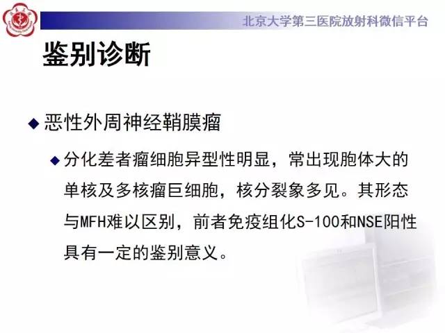 【病例】心脏原发性肿瘤1例CT影像表现