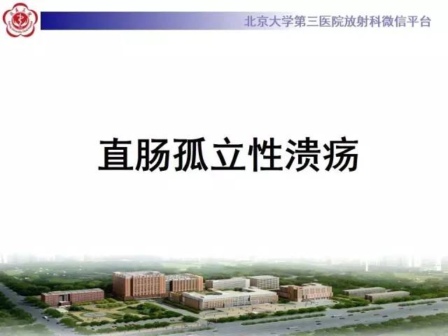 【病例】直肠孤立性溃疡1例CT及MR影像诊断