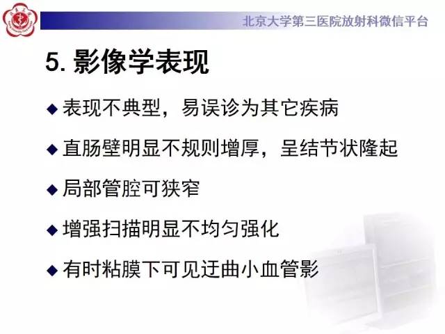 【病例】直肠孤立性溃疡1例CT及MR影像诊断