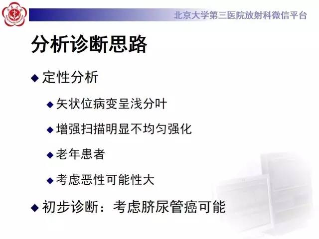 【病例】脐尿管癌1例CT影像诊断