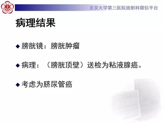 【病例】脐尿管癌1例CT影像诊断