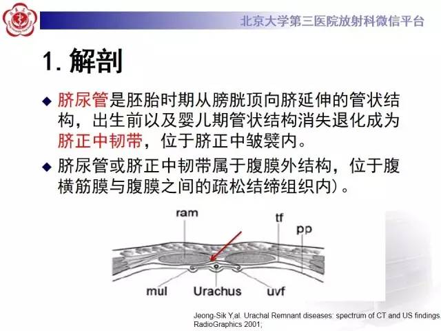 【病例】脐尿管癌1例CT影像诊断