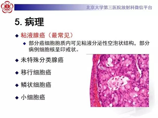 【病例】脐尿管癌1例CT影像诊断