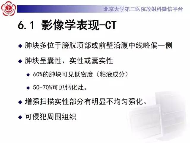 【病例】脐尿管癌1例CT影像诊断