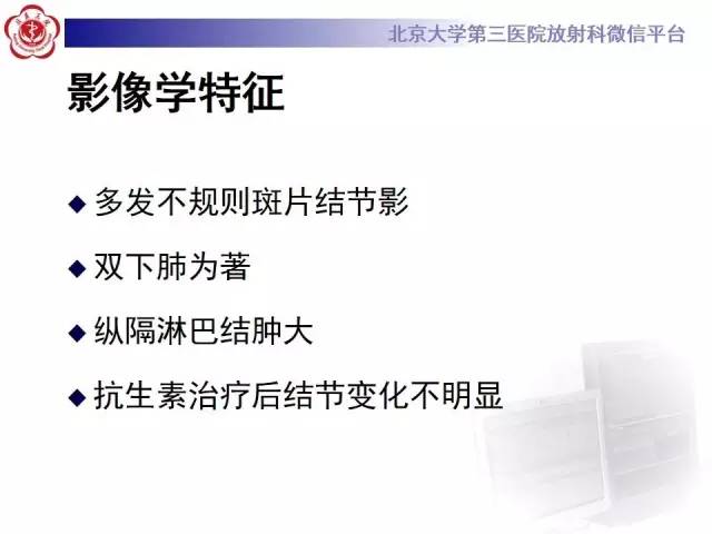 【病例】肺部肉芽肿性血管炎1例CT影像表现