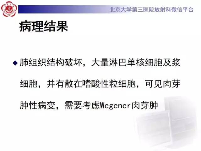 【病例】肺部肉芽肿性血管炎1例CT影像表现