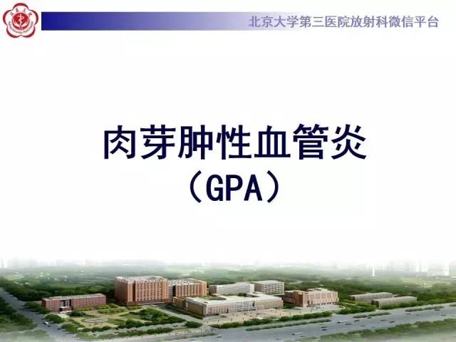 【病例】肺部肉芽肿性血管炎1例CT影像表现
