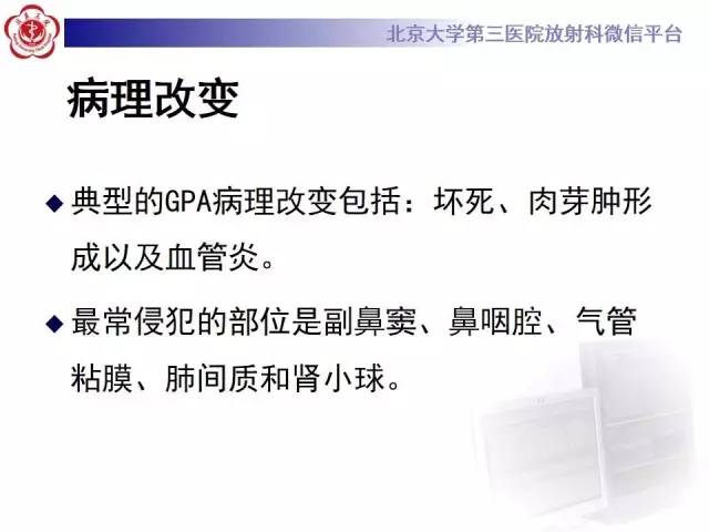 【病例】肺部肉芽肿性血管炎1例CT影像表现
