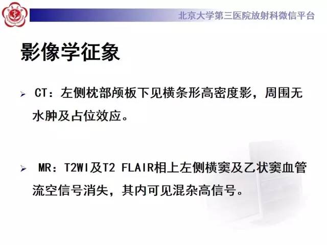 【病例】颅内静脉窦血栓形成1例CT及MR