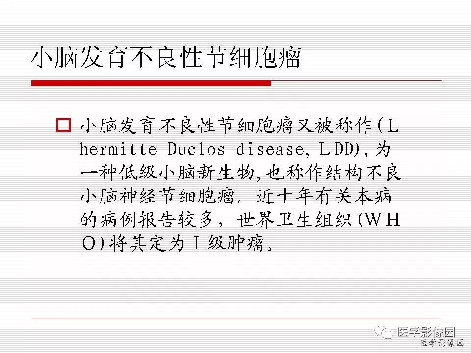 【病例】小脑发育不良性节细胞瘤1例MR影像表现