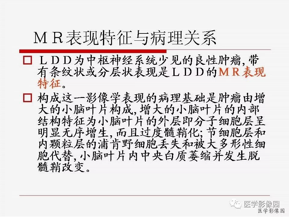 【病例】小脑发育不良性节细胞瘤1例MR影像表现