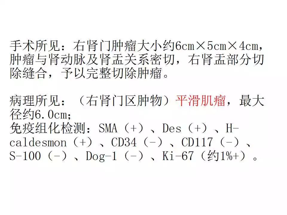 【病例】肾脏平滑肌瘤1例CT影像表现 【病例】肾脏平滑肌瘤1例CT影像表现