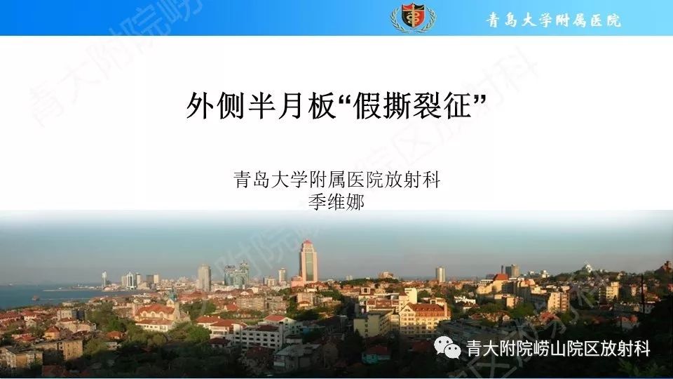 【PPT】外侧半月板“假撕裂征”