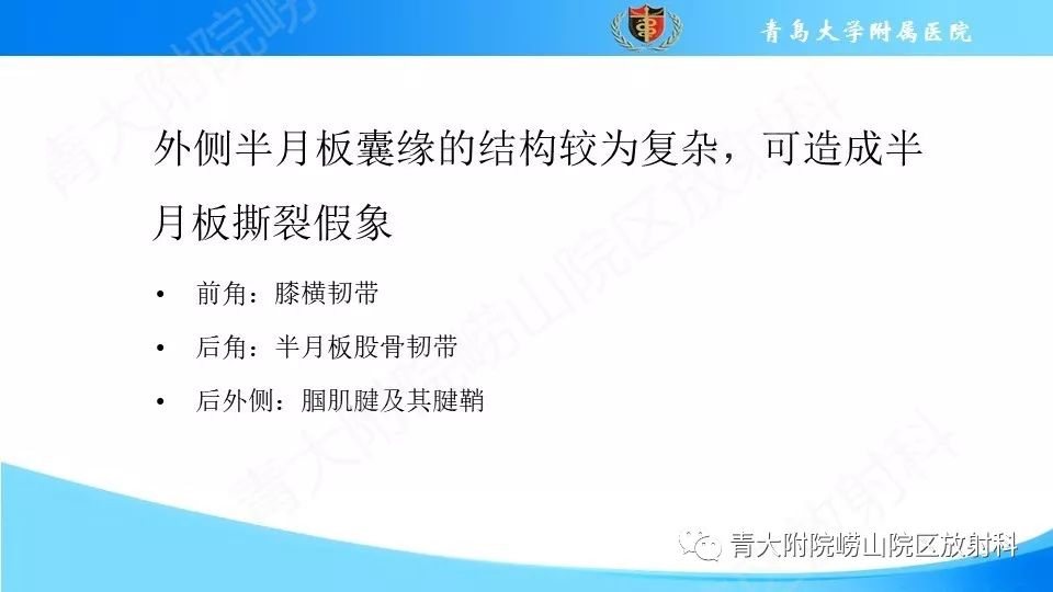 【PPT】外侧半月板“假撕裂征”