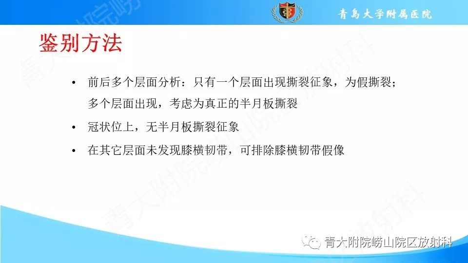 【PPT】外侧半月板“假撕裂征”