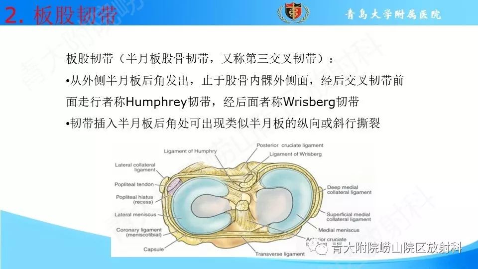 【PPT】外侧半月板“假撕裂征”