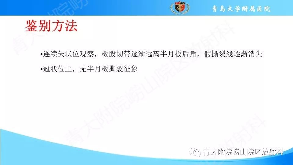 【PPT】外侧半月板“假撕裂征”