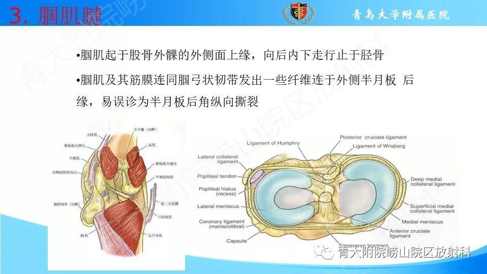 【PPT】外侧半月板“假撕裂征”