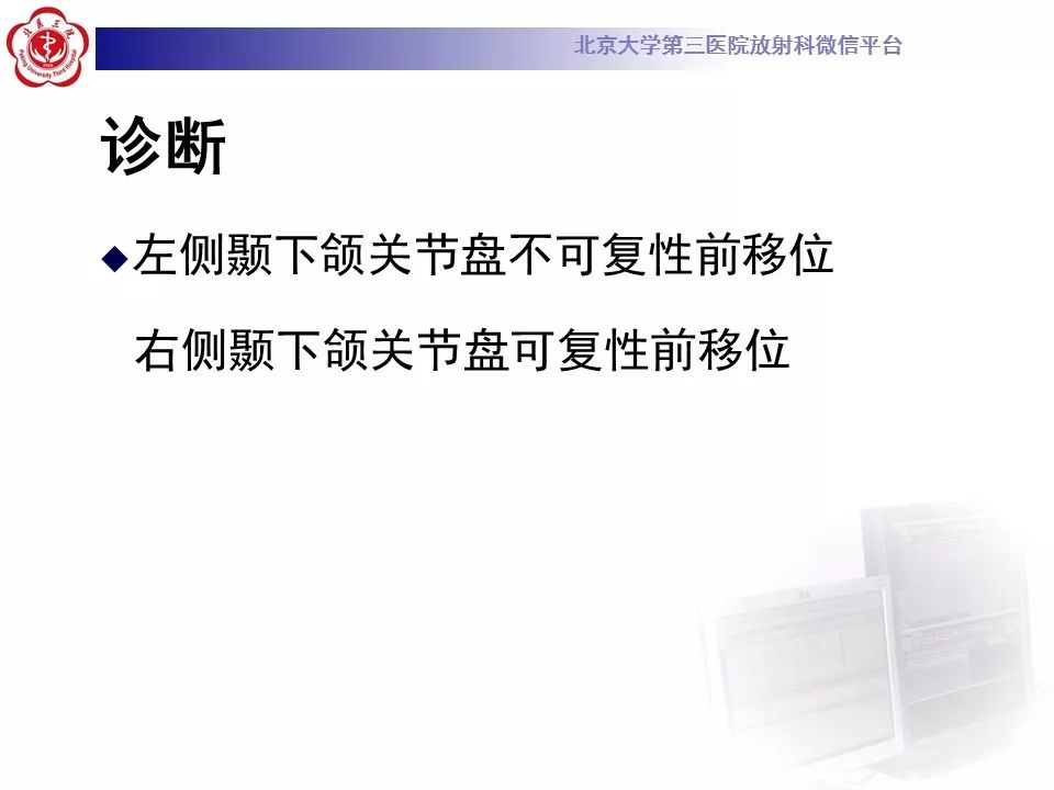 【病例】颞下颌关节紊乱病1例MR影像诊断