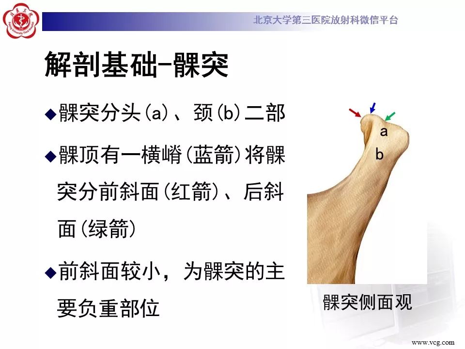 【病例】颞下颌关节紊乱病1例MR影像诊断