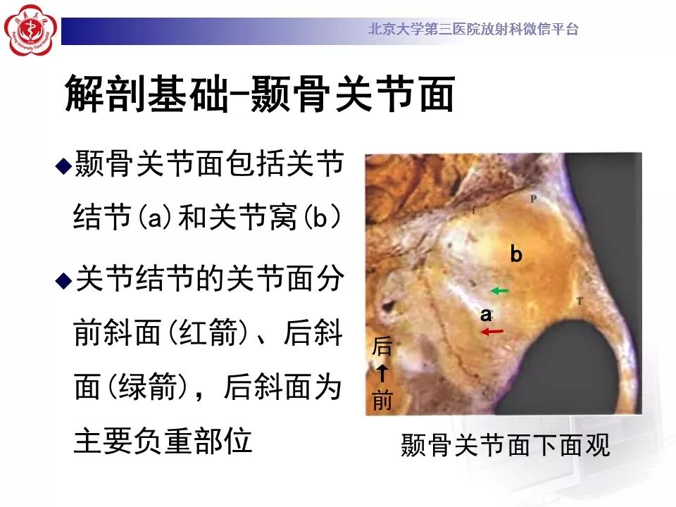 【病例】颞下颌关节紊乱病1例MR影像诊断