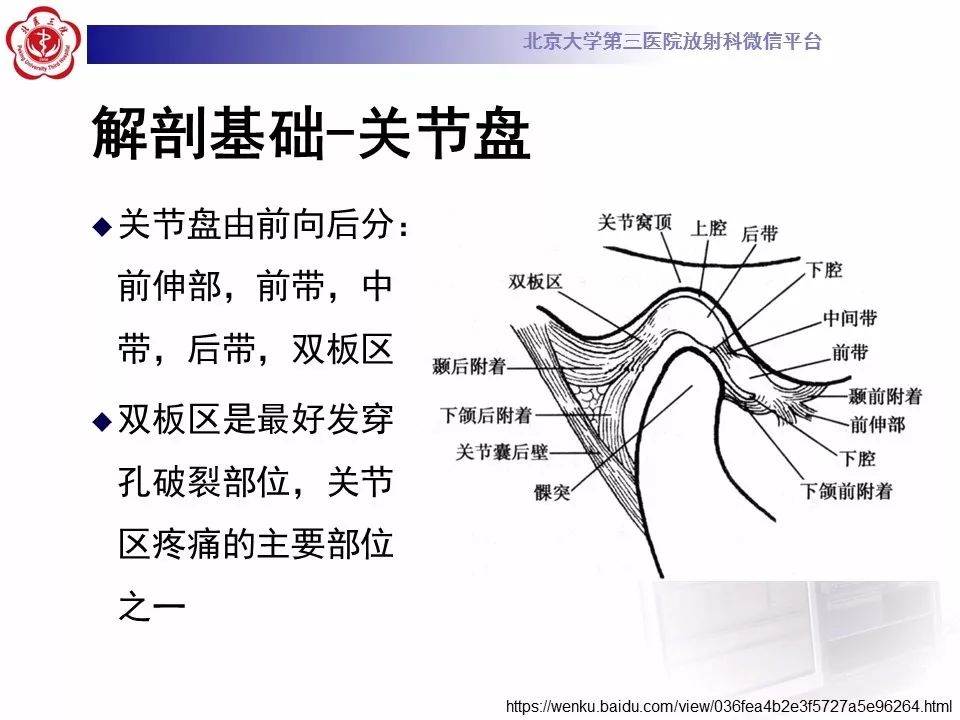 【病例】颞下颌关节紊乱病1例MR影像诊断