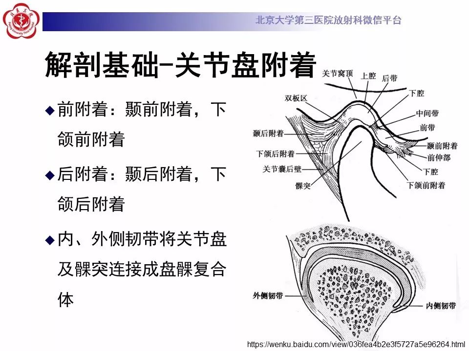 【病例】颞下颌关节紊乱病1例MR影像诊断