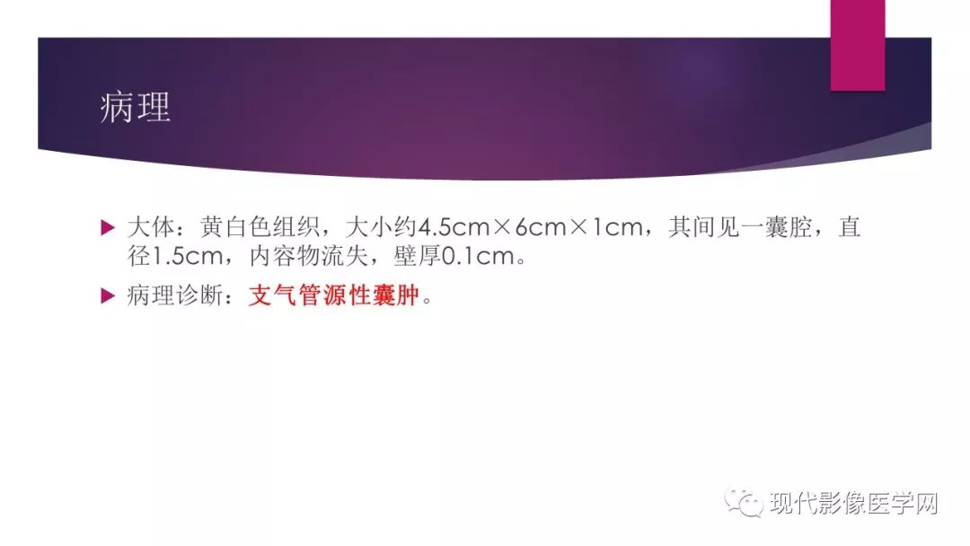 【病例】纵隔支气管源性囊肿1例CT影像表现