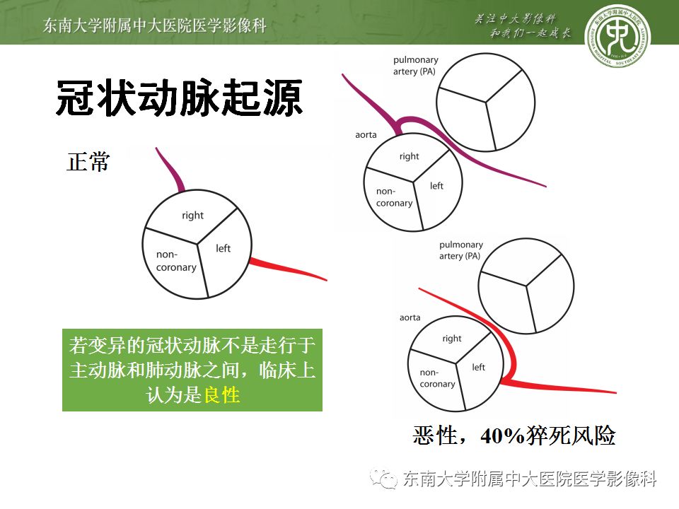 【病例】冠脉CTA一例—冠脉疾病报告和数据系统