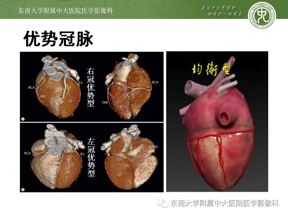【病例】冠脉CTA一例—冠脉疾病报告和数据系统