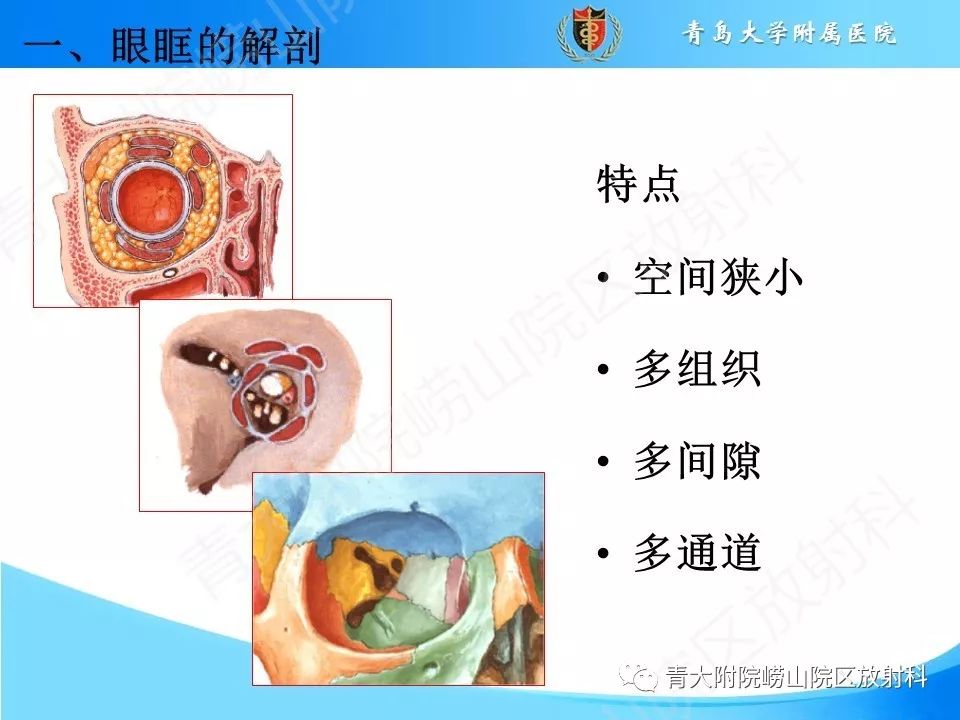 【PPT】眼眶肿瘤的影像诊断