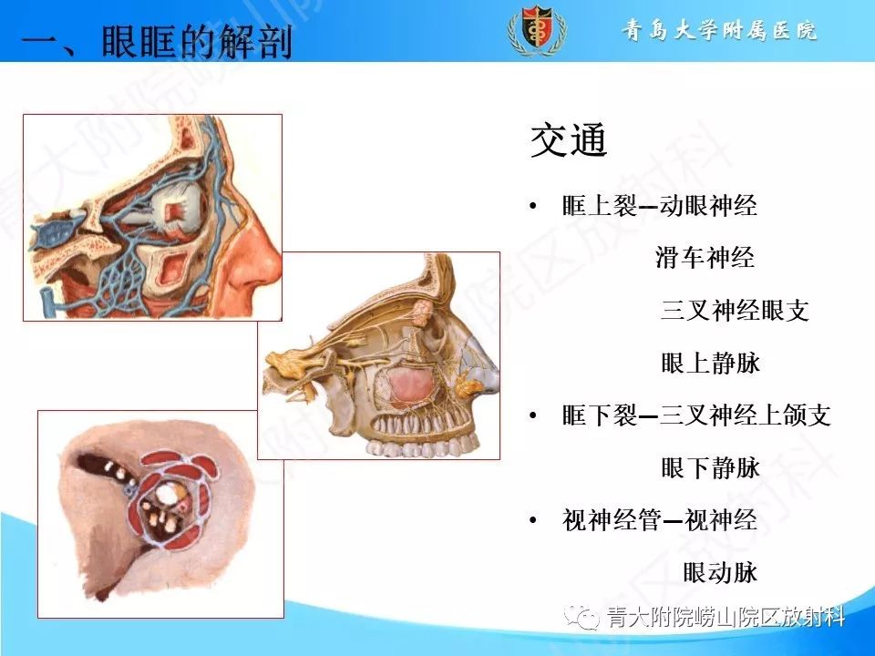 【PPT】眼眶肿瘤的影像诊断