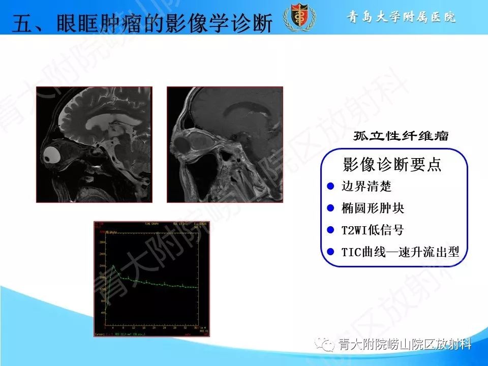 【PPT】眼眶肿瘤的影像诊断