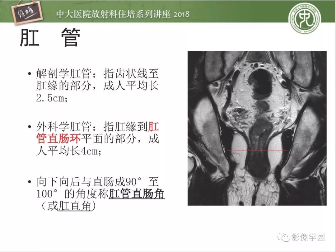 【PPT】直肠癌MR分期及报告