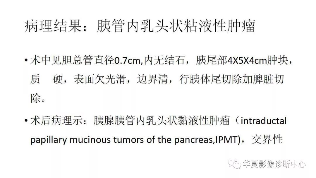 【病例】胰腺胰管内乳头状粘液性肿瘤1例CT及MR