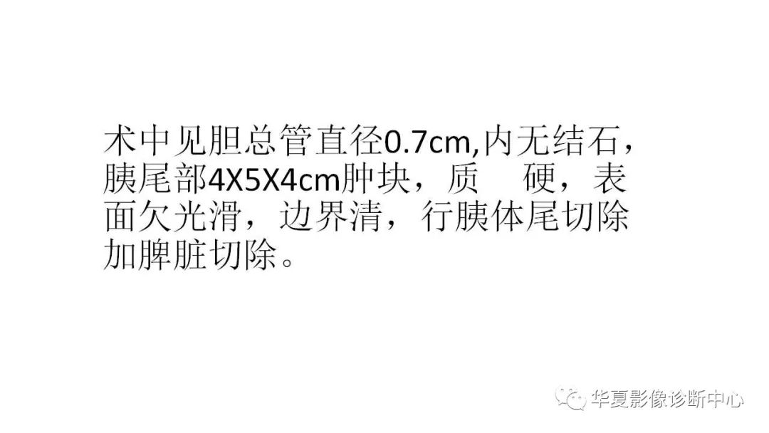 【病例】胰腺胰管内乳头状粘液性肿瘤1例CT及MR