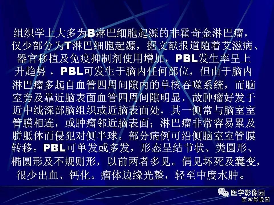 【病例】中枢神经系统淋巴瘤1例MR