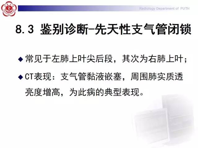 【病例】变态反应性支气管肺曲霉菌病1例CT