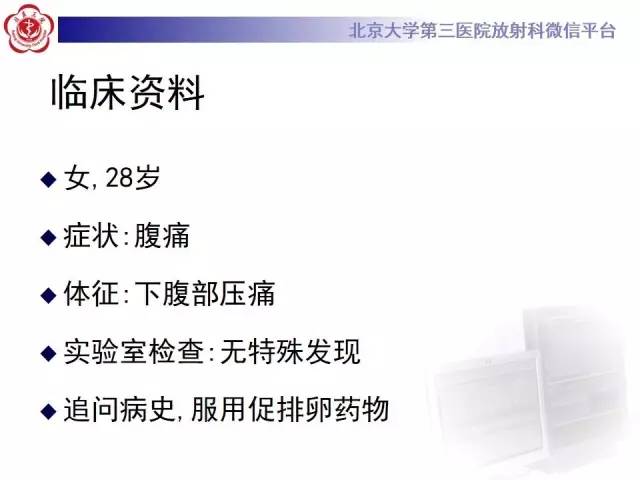【病例】卵巢过度刺激综合征1例CT影像表现