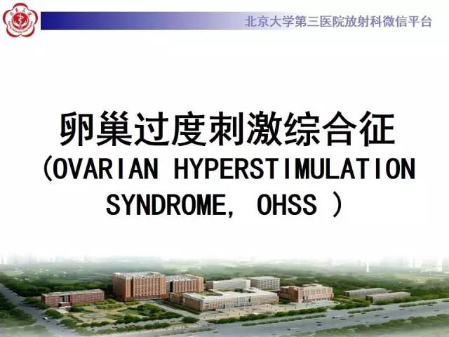 【病例】卵巢过度刺激综合征1例CT影像表现