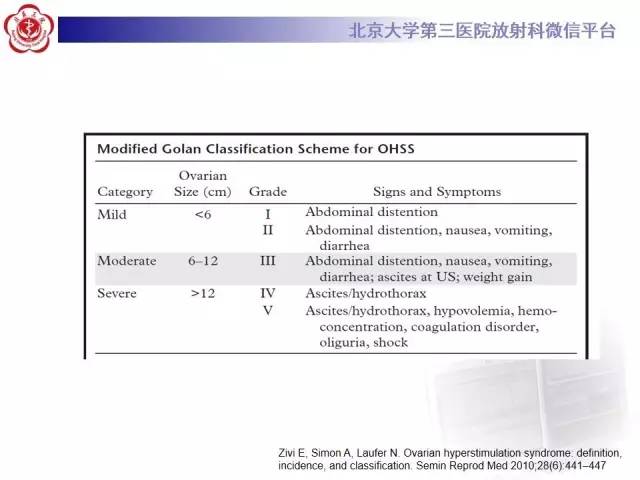 【病例】卵巢过度刺激综合征1例CT影像表现