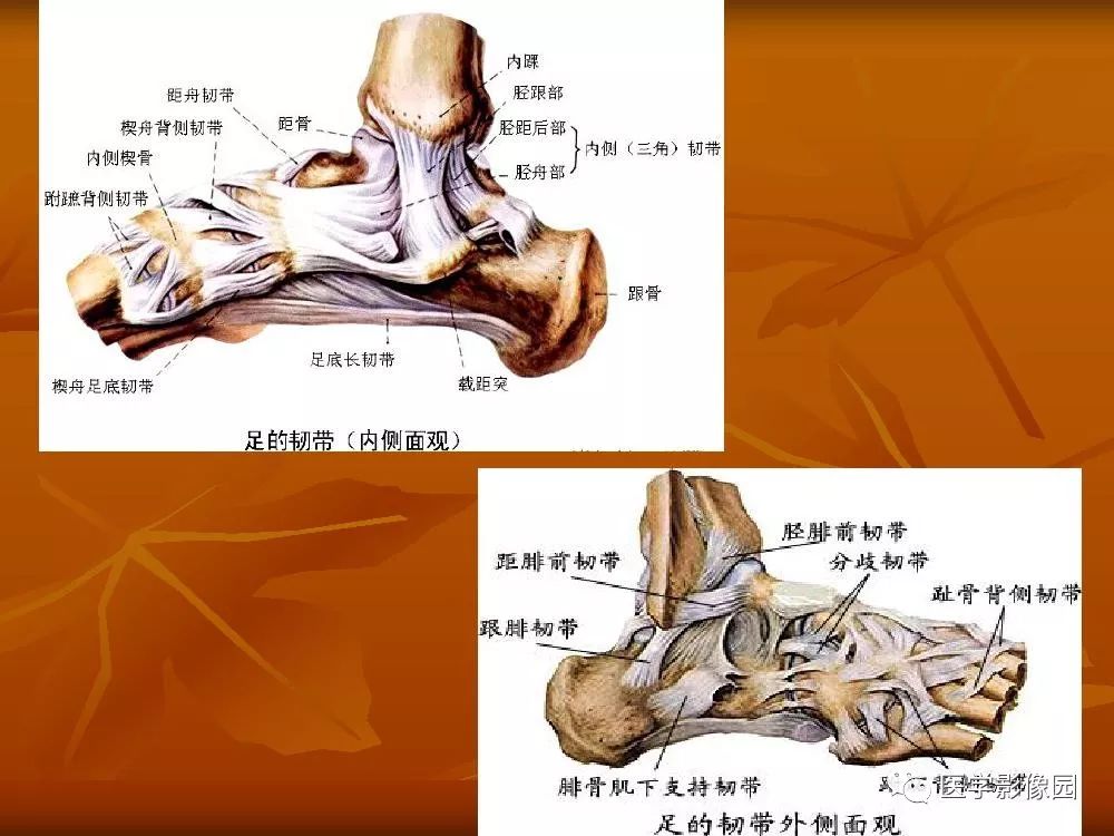 【PPT】踝关节韧带的解剖及影像表现