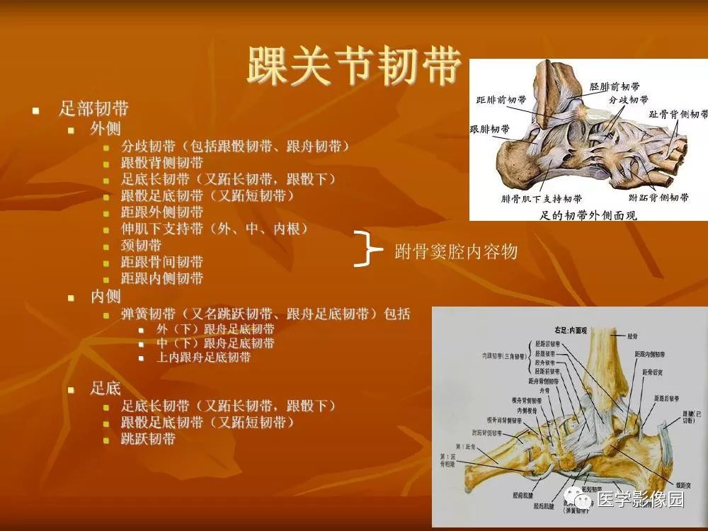 【PPT】踝关节韧带的解剖及影像表现