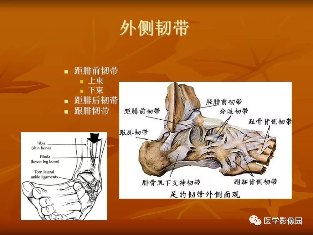 【PPT】踝关节韧带的解剖及影像表现