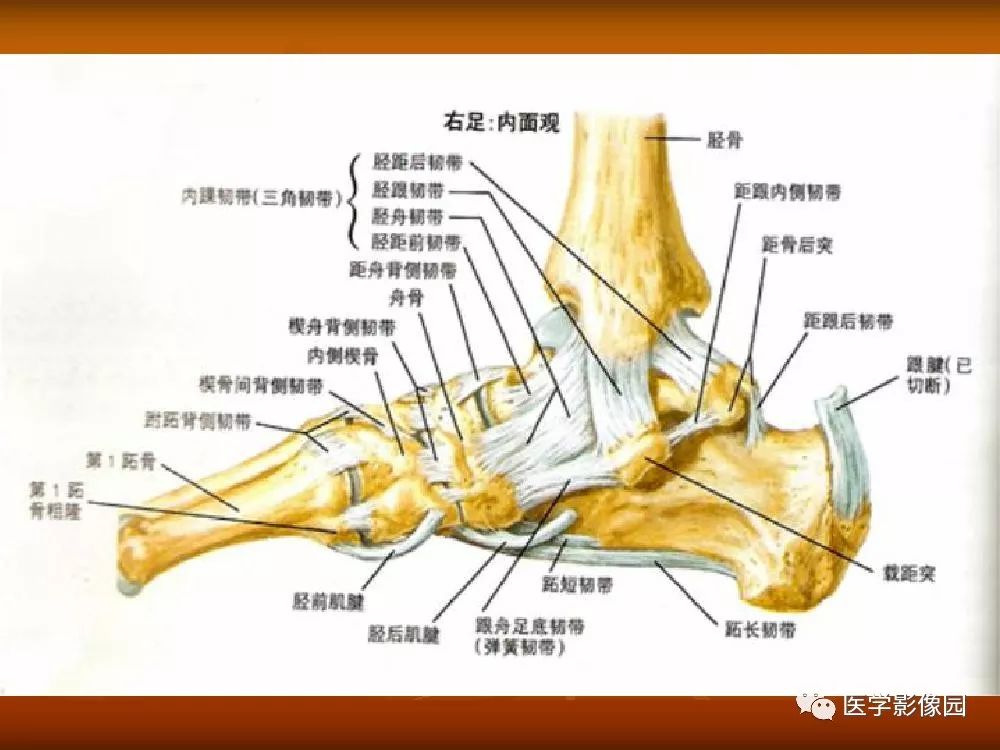 【PPT】踝关节韧带的解剖及影像表现