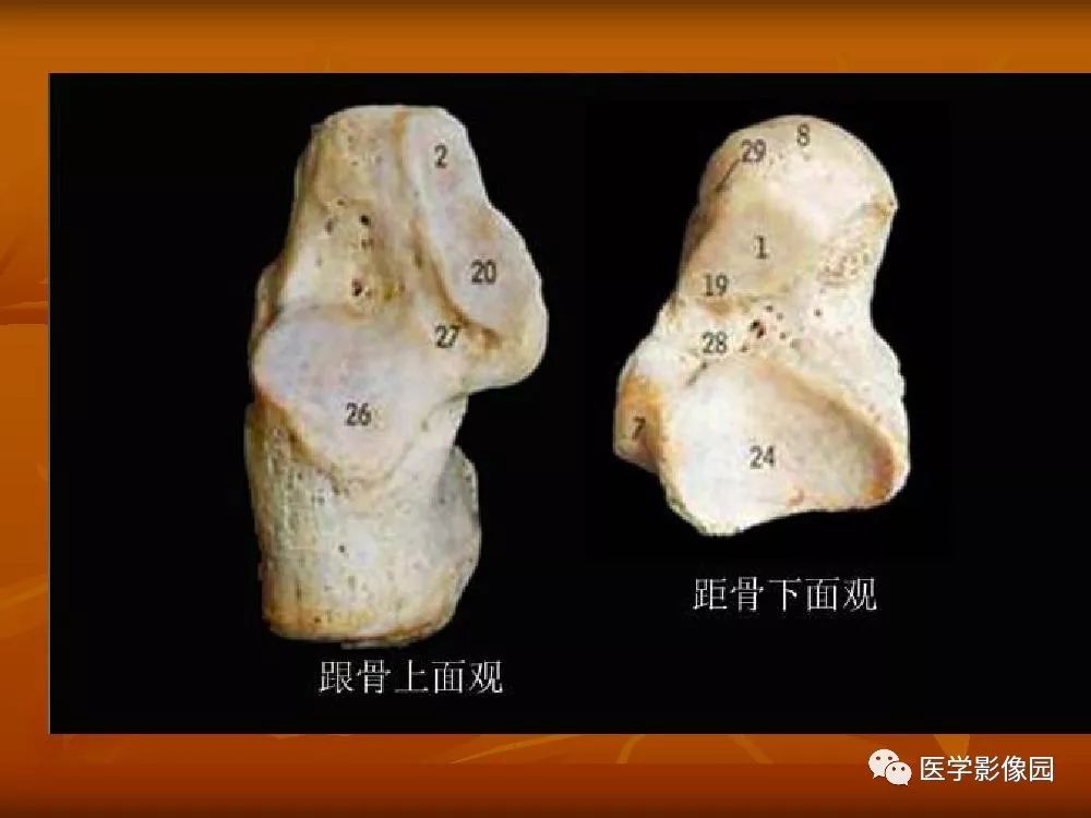 【PPT】踝关节韧带的解剖及影像表现