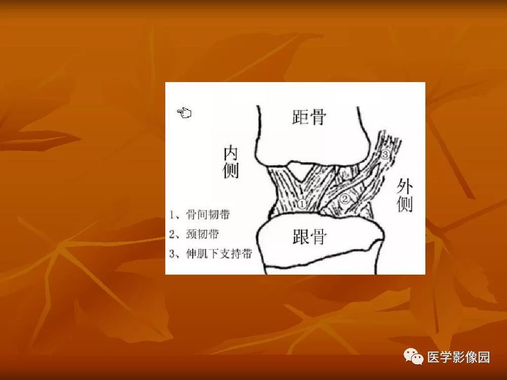 【PPT】踝关节韧带的解剖及影像表现