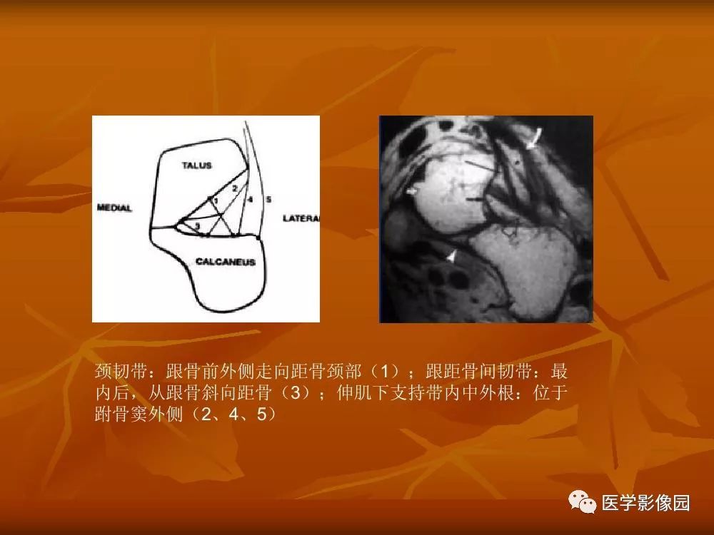 【PPT】踝关节韧带的解剖及影像表现